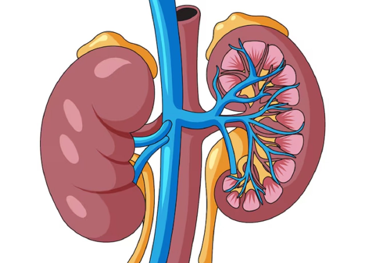 Kapalı Taş Ameliyatı Nedir Avantajları Neler